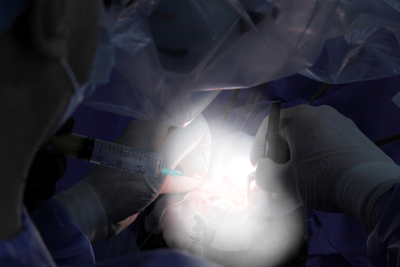 beyin ameliyatı, beyin tümörü ameliyatı