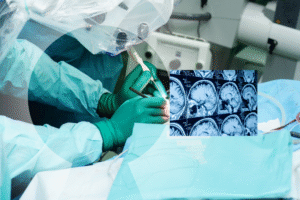 beyin tümörü ameliyatı