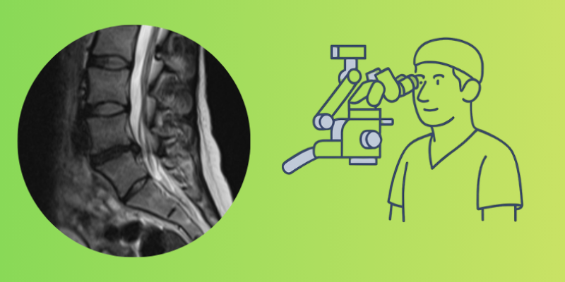 bel fıtığı ameliyatı