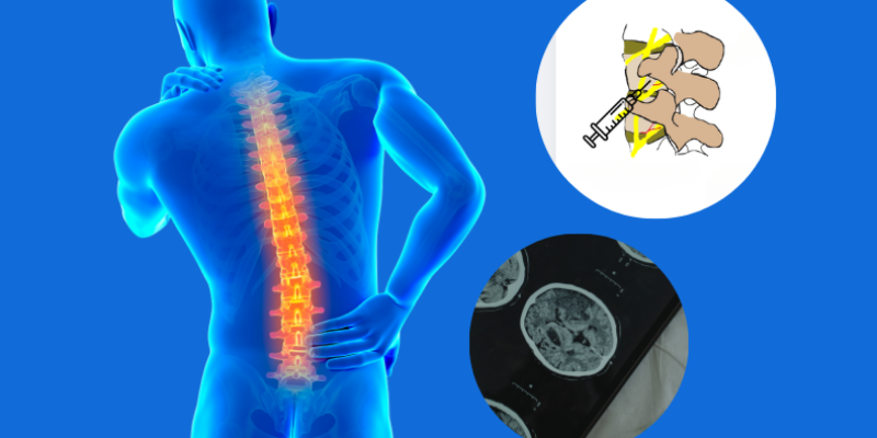 beyin cerrahisi haydarpaşa