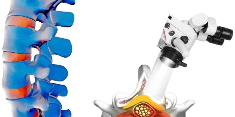 vidasız dar kanal ameliyatı